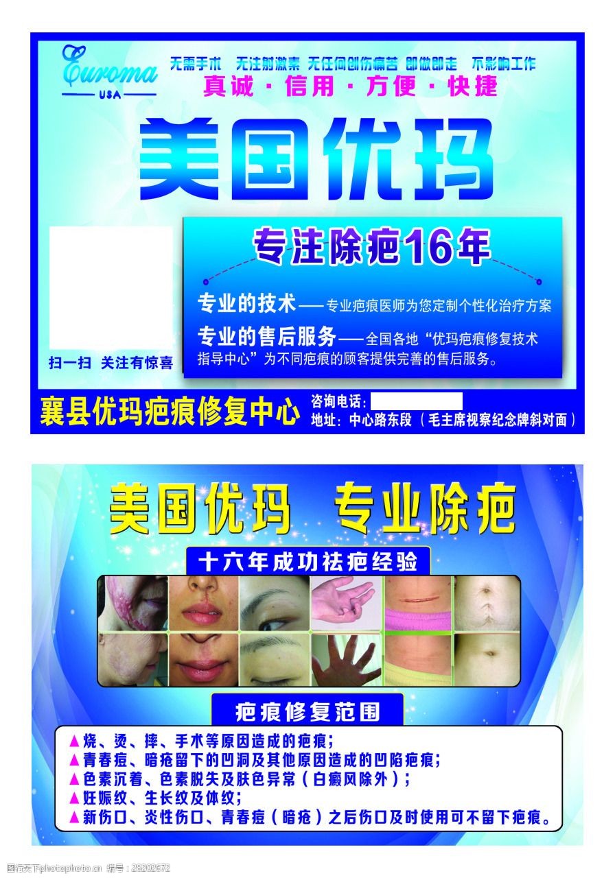 美国优玛祛疤