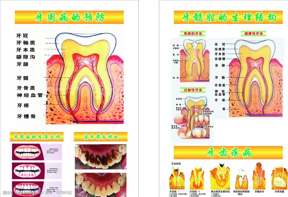 关键词:牙周病展板 牙 牙周病的预防 展板 牙齿 牙齿疾病 牙髓腔 设计